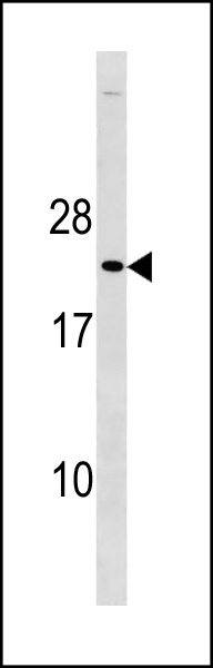Rabbit Polyclonal Antibody to Mouse p27Kip1 (C-term T197)