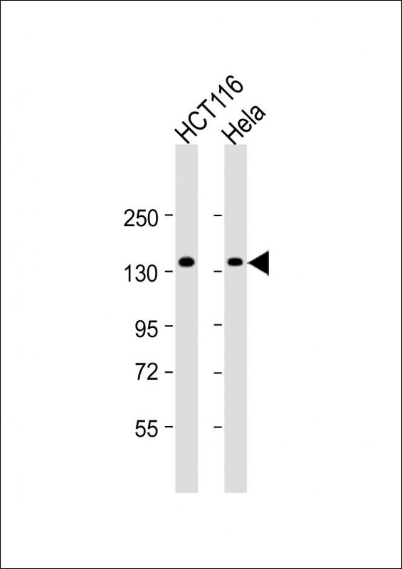 ANKS1A (N-term)