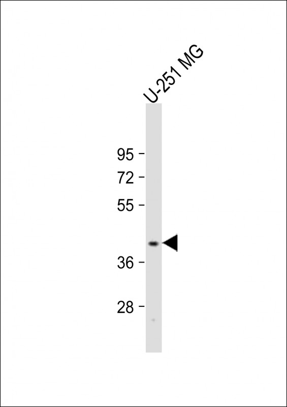 PNPLA5