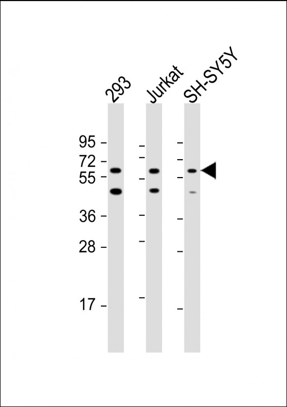 HEXDC (N-Term)