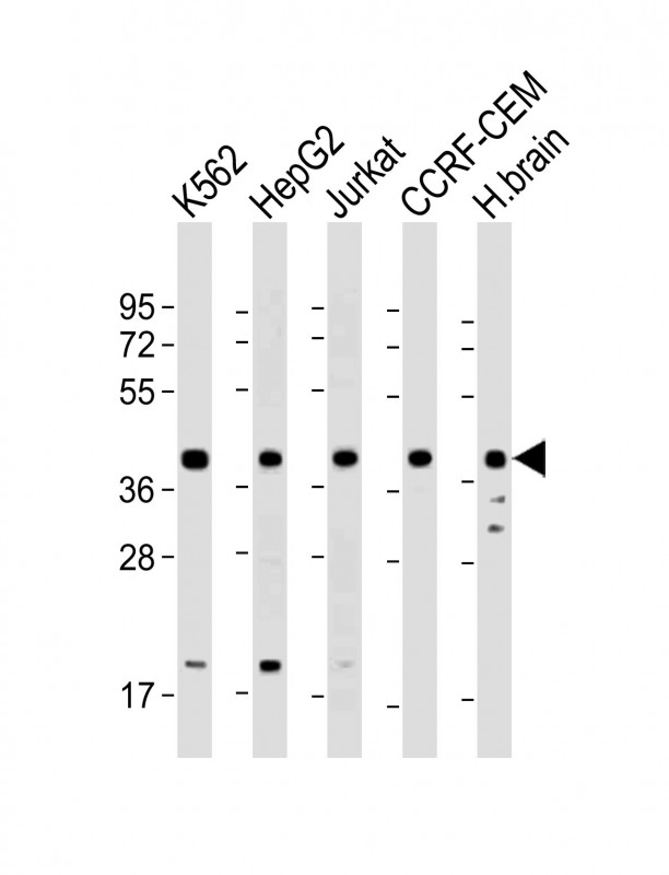 Cyclophilin D
