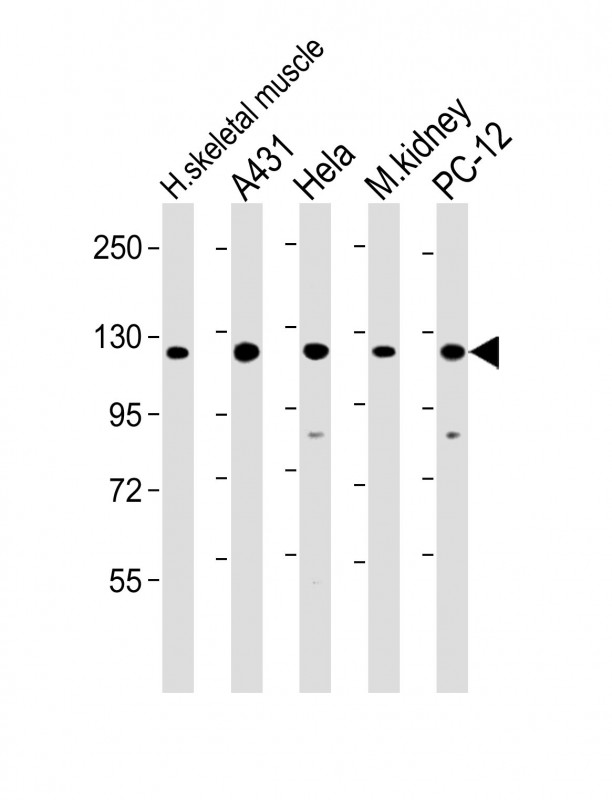 Vinculin