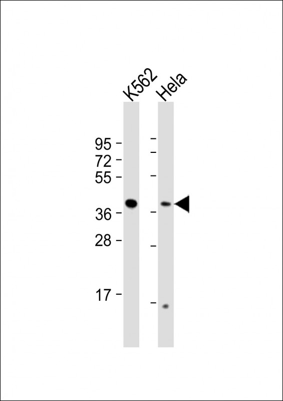 RFC2 (N-term)