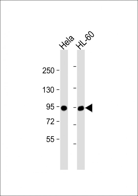 IL3RB (C-term V759)