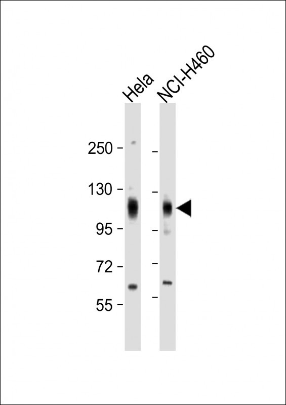 EphA4 (N-term)
