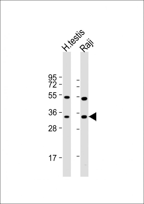 HSD17B3