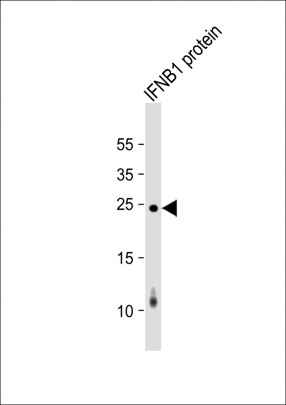 IFNB1