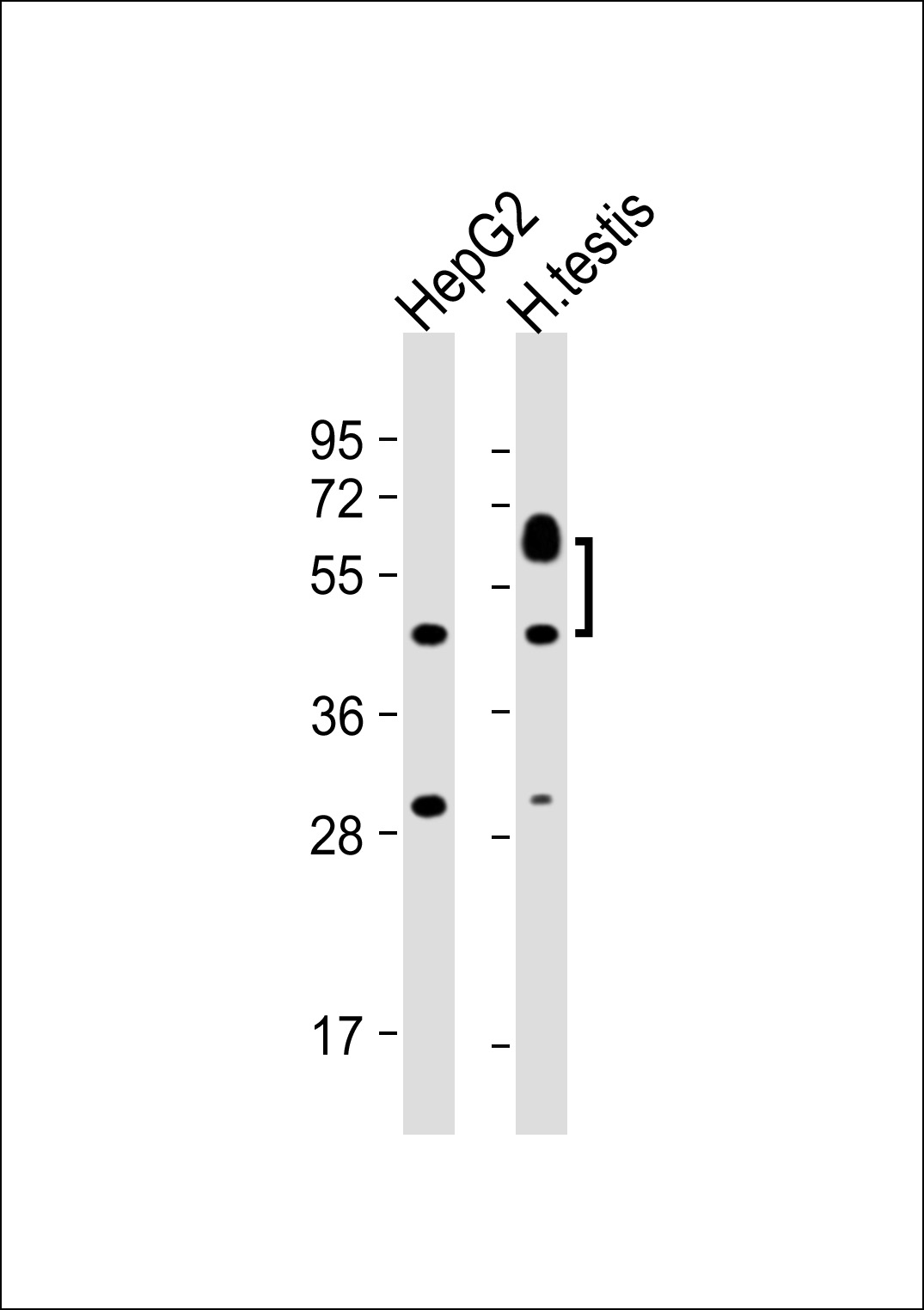 SPATC1 (N-term)