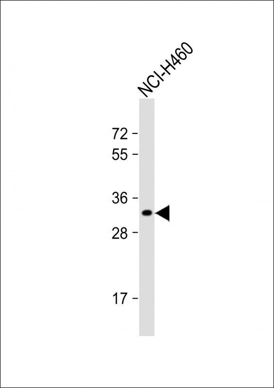 OR2B11