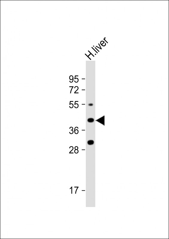 FADS6