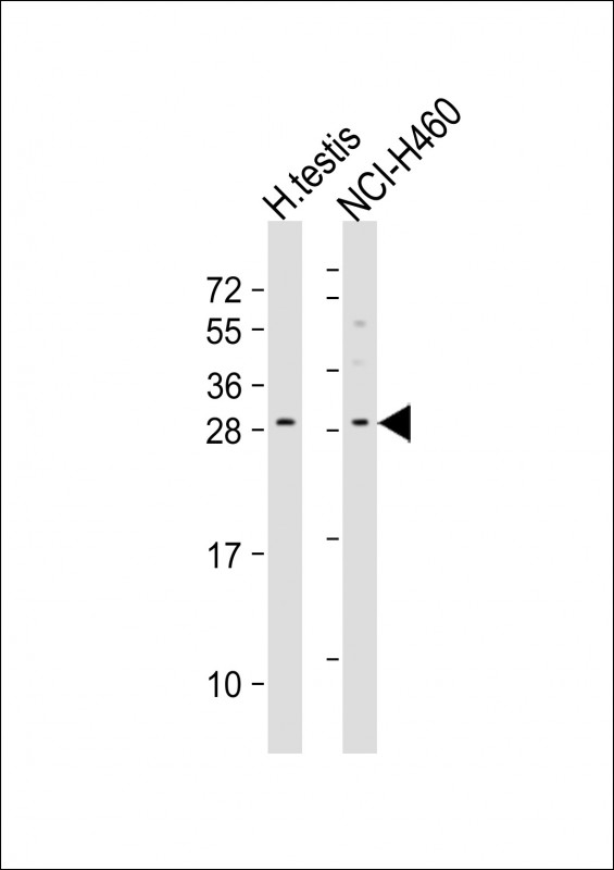 LCN9 (N-term)