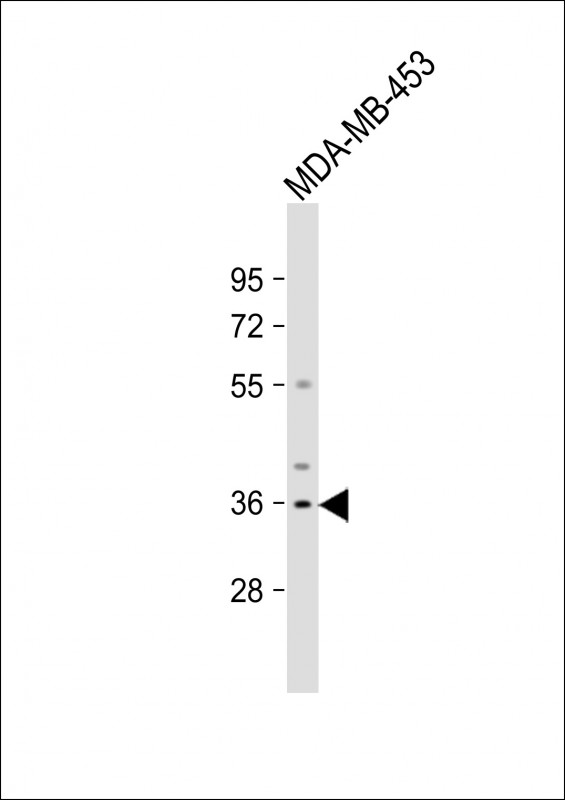 OR51Q1 (N-term)