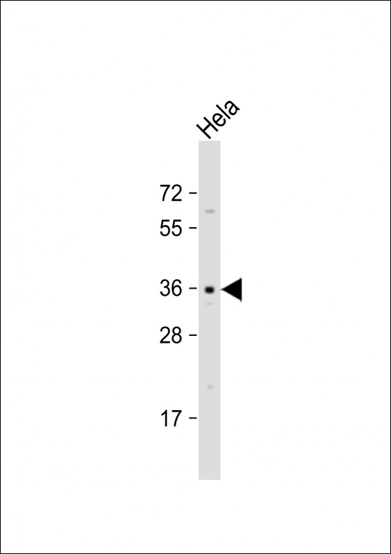 OR52E2