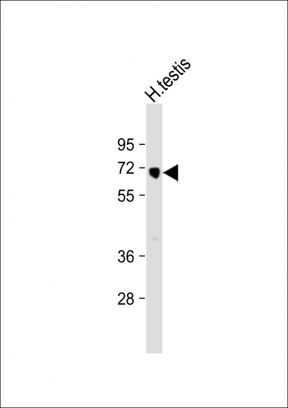 HIPK4