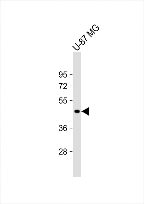 VAT1L