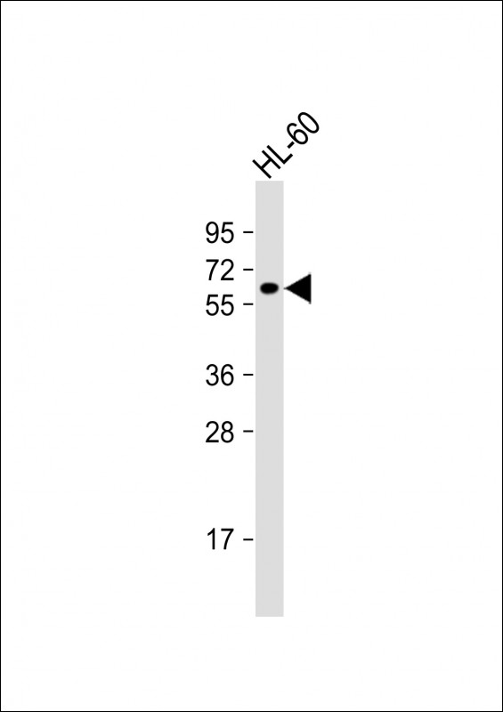 KLHL3