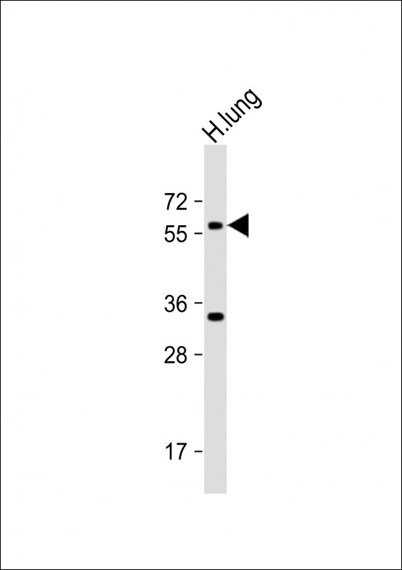 ASB2 (N-term)