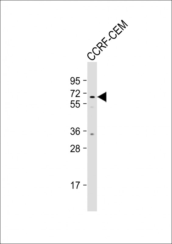 MSL2 (N-term)