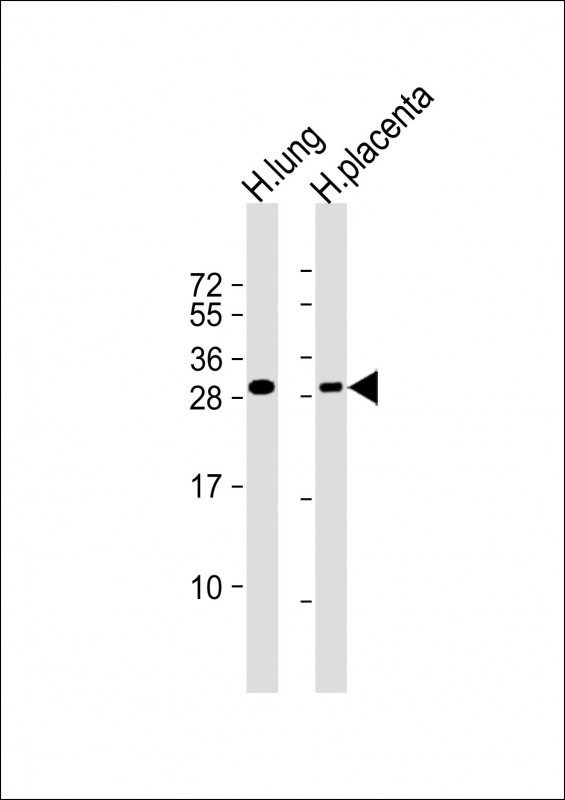 RGS19 (S24)