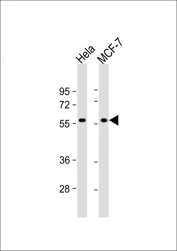 TIGD1 (N-term)