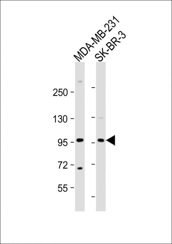 TCHHL1 (N-term)