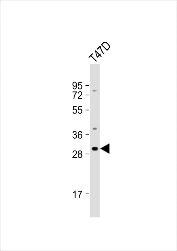 OR10T2