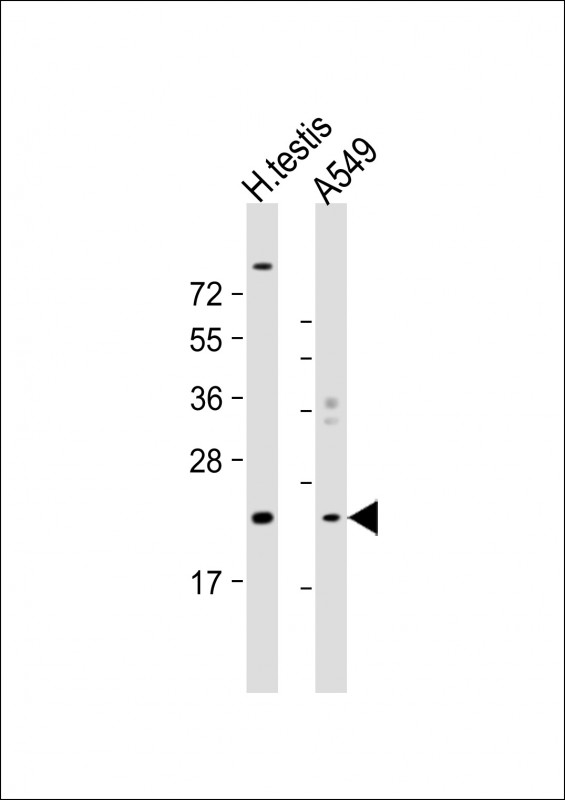 HSPB9