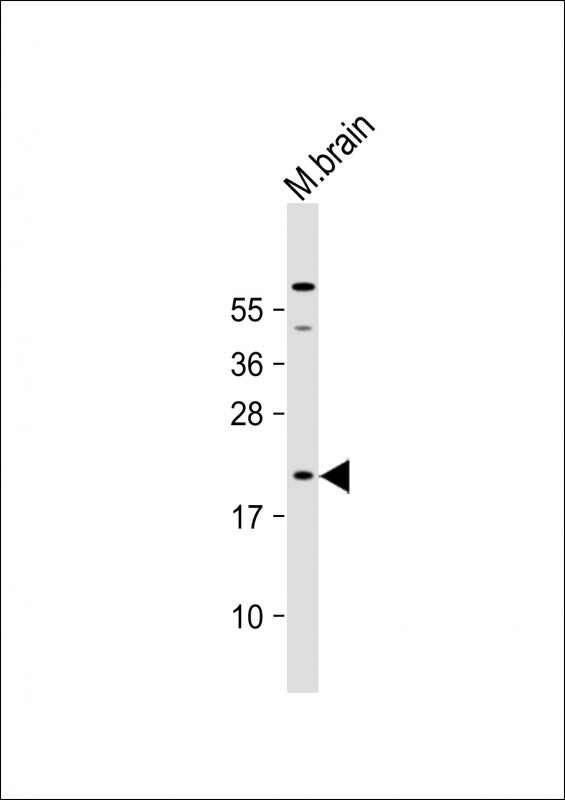 Mouse Hras1(C-term)