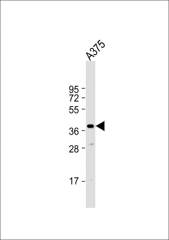PIH1D1(Center)