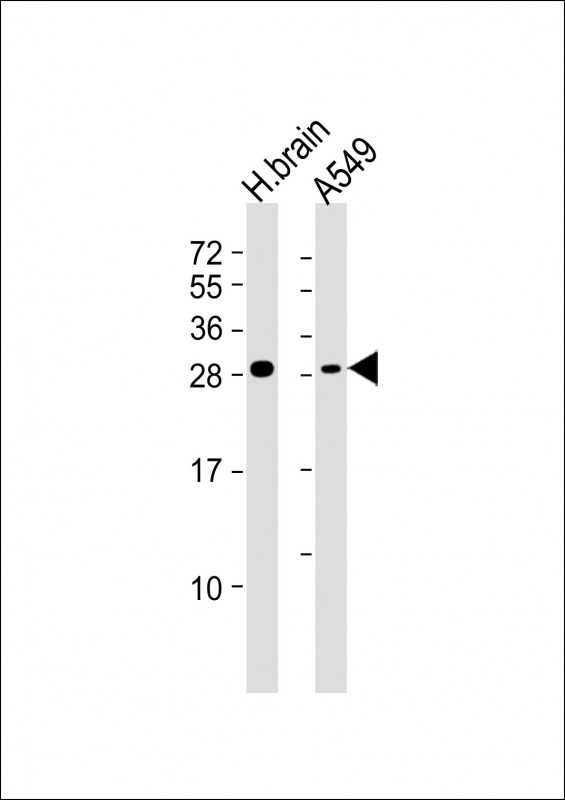 ASCL1 (Achaete-scute homolog 1) (C-term D220)
