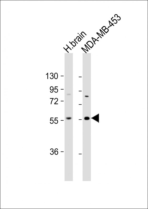 IGSF21 (N-term)