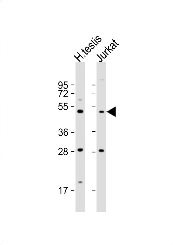 OXCT2