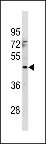 Rabbit Polyclonal Antibody to MTCH1