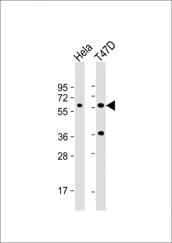 USP21 (N-term P31)