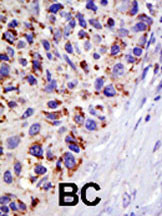 Rabbit Polyclonal Antibody to USP21 (N-term P31)