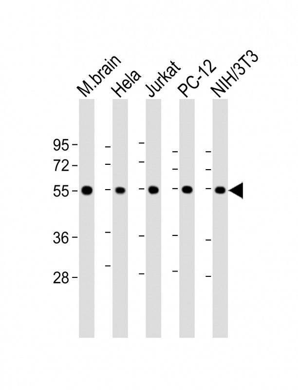 beta II Tubulin
