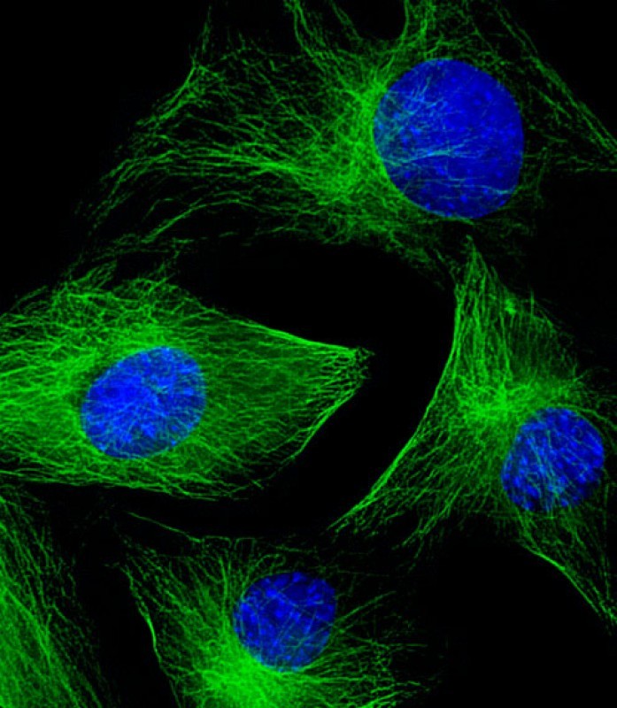 Rabbit Polyclonal Antibody to beta II Tubulin