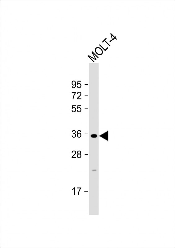GLT6D1