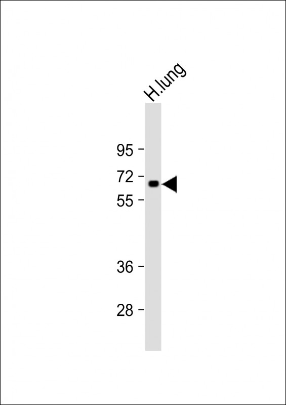 CSRNP1