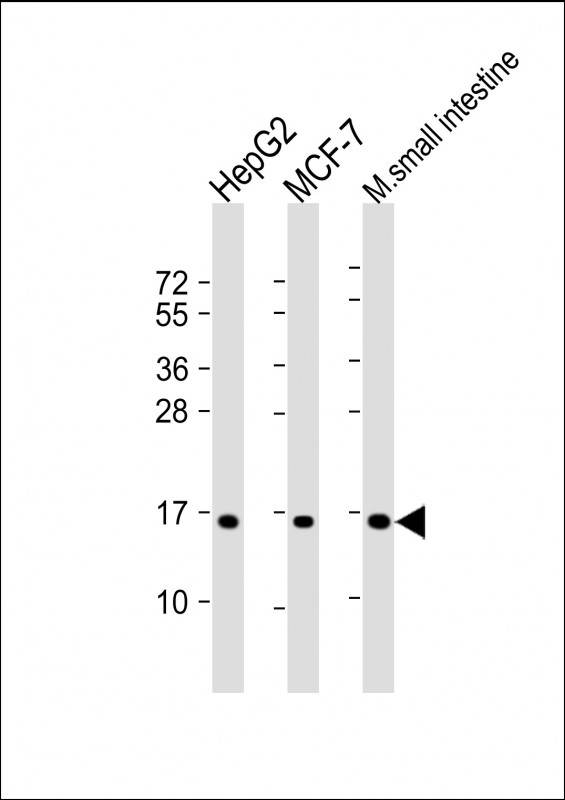 COXIV Isoform 2