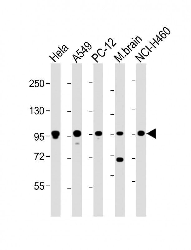 PCSK1