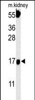 Rabbit Polyclonal Antibody to FGFBP3