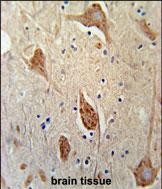 Rabbit Polyclonal Antibody to FGFBP3