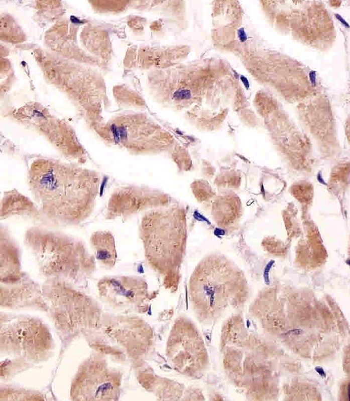 Rabbit Polyclonal Antibody to VLDLR