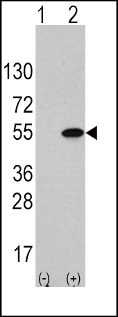 Rabbit Polyclonal Antibody to ATF4