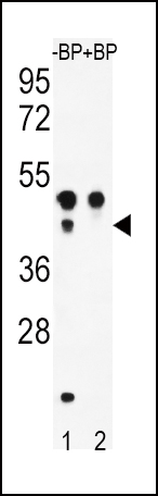 Rabbit Polyclonal Antibody to ATF4