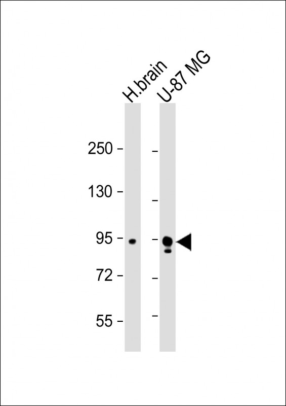 Synphilin-1 (SNCAIP)