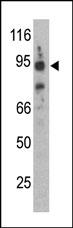 Rabbit Polyclonal Antibody to Synphilin-1 (SNCAIP)