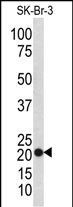 Rabbit Polyclonal Antibody to TAGLN (N-term)
