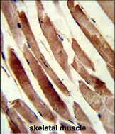 Rabbit Polyclonal Antibody to TAGLN (N-term)